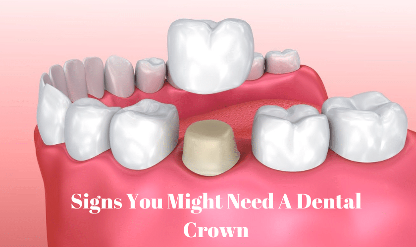 Signs You Might Need A Dental Crown