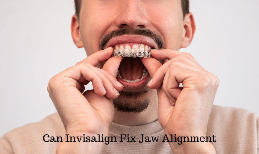 Can Invisalign Fix Jaw Alignment