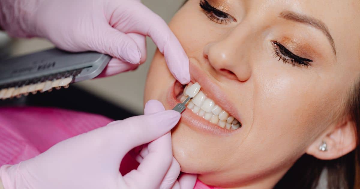 tips for caring for your veneers to ensure their longevity
