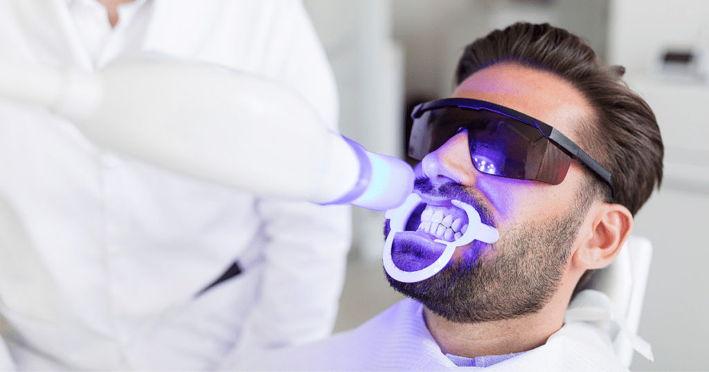 How Often Should You Whiten Your Teeth