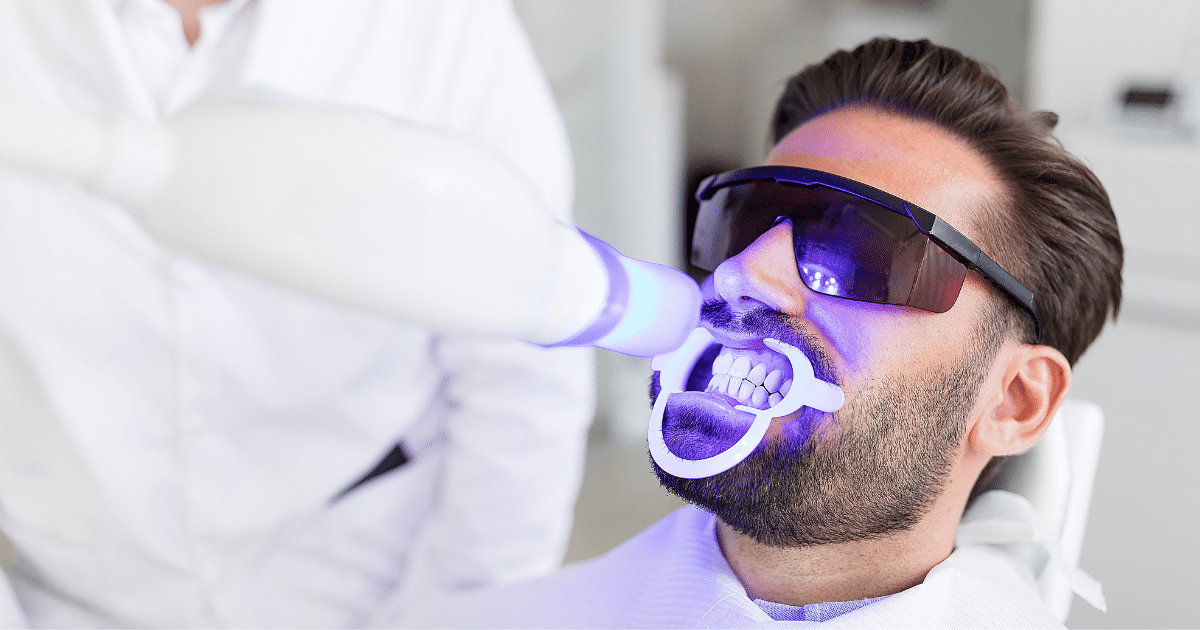 How Often Should You Whiten Your Teeth
