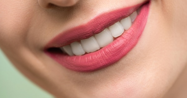 get a radiant smile for valentines day with these teeth whitening hacks